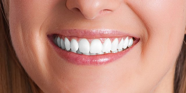 dentalimplants2